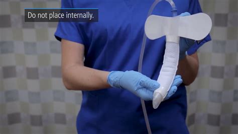 The PureWick™ System was designed with you in mind, with features that include: Non-invasive; works outside the body to wick urine away. . Primafit catheter cost